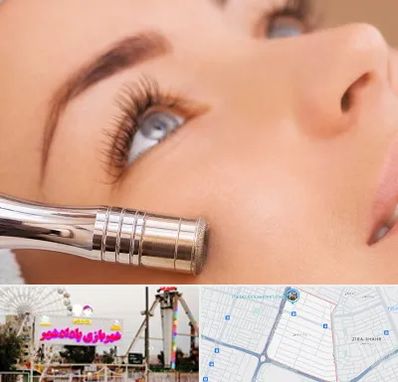 میکرودرم در پادادشهر اهواز