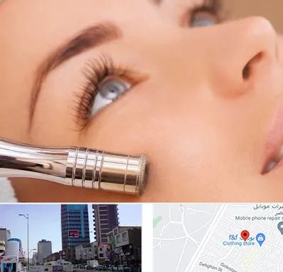 میکرودرم در چهارراه طالقانی کرج