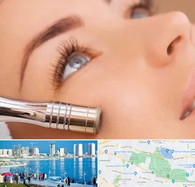 میکرودرم در چیتگر 