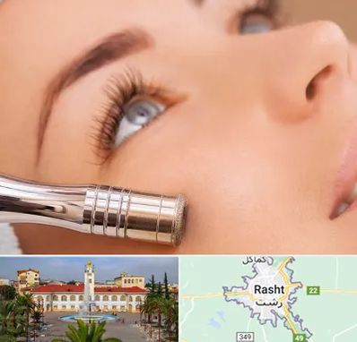 میکرودرم در رشت