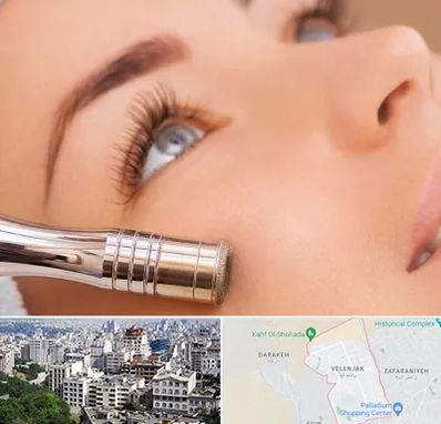 میکرودرم در ولنجک 