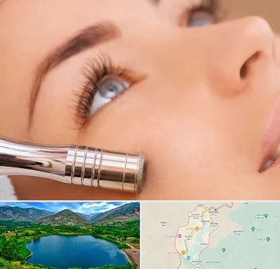 میکرودرم در رودبار