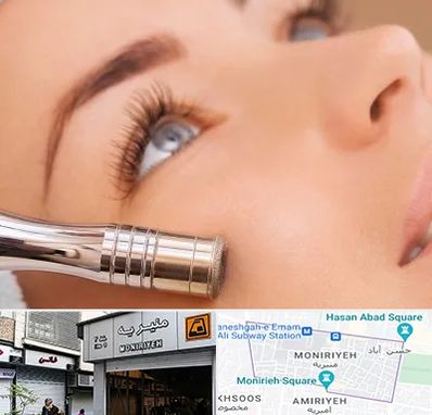 میکرودرم در منیریه 