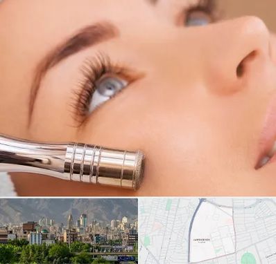 میکرودرم در جمشیدیه