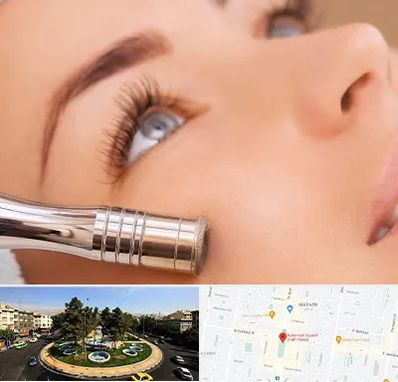 میکرودرم در هفت حوض 