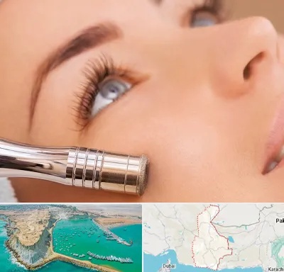میکرودرم در سیستان و بلوچستان