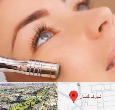 میکرودرم در شهرک گلستان