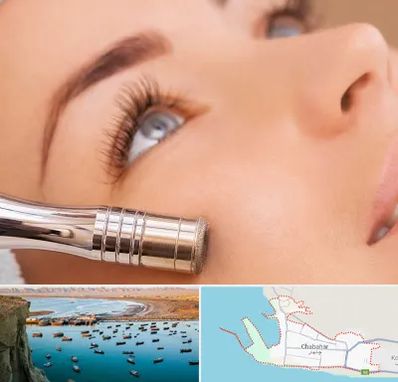 میکرودرم در چابهار