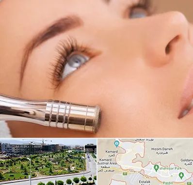 میکرودرم در پردیس