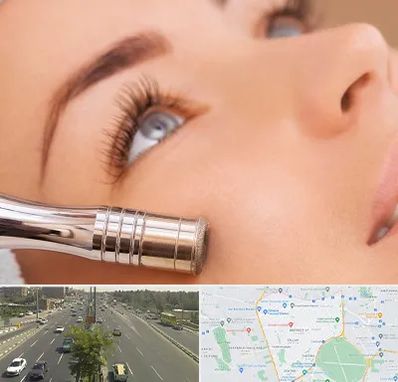 میکرودرم در منطقه 17 تهران 