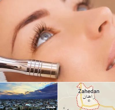 میکرودرم در زاهدان