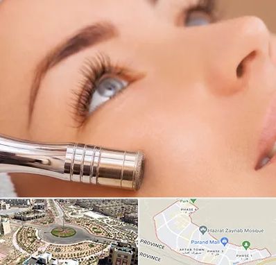 میکرودرم در پرند