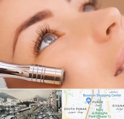 میکرودرم در پونک 