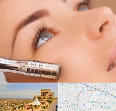 میکرودرم در هاشمیه مشهد