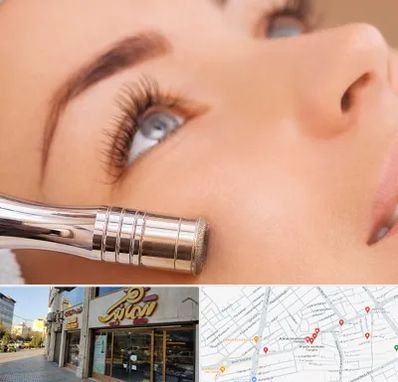 میکرودرم در عطاران قم