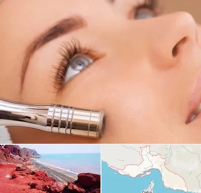 میکرودرم در هرمزگان