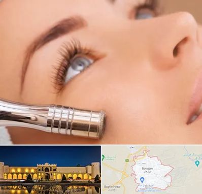 میکرودرم در برازجان