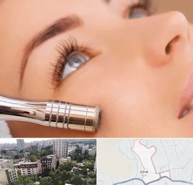 میکرودرم در اوین