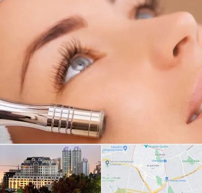 میکرودرم در فرشته 