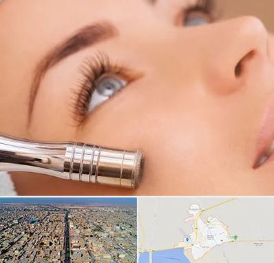 میکرودرم در بندر ماهشهر