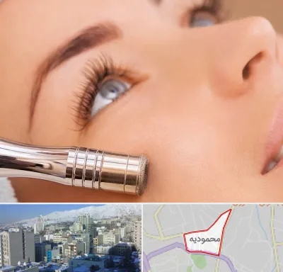 میکرودرم در محمودیه