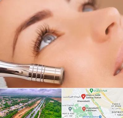 میکرودرم در قصرالدشت شیراز