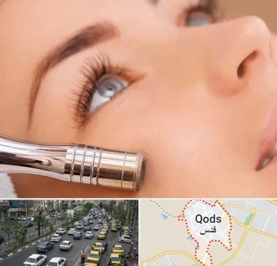 میکرودرم در شهر قدس