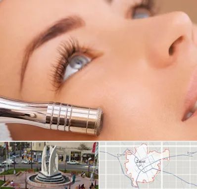 میکرودرم در زابل