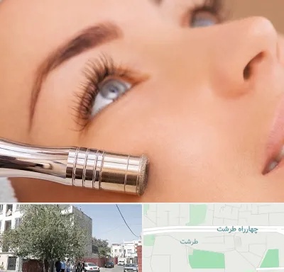 میکرودرم در طرشت