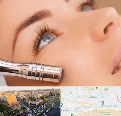 میکرودرم در تهرانپارس 