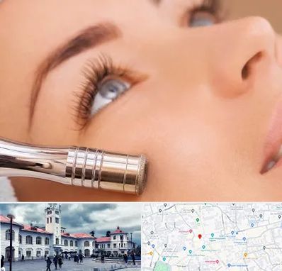 میکرودرم در میدان شهرداری رشت