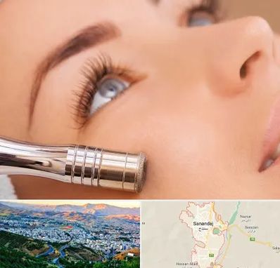 میکرودرم در سنندج