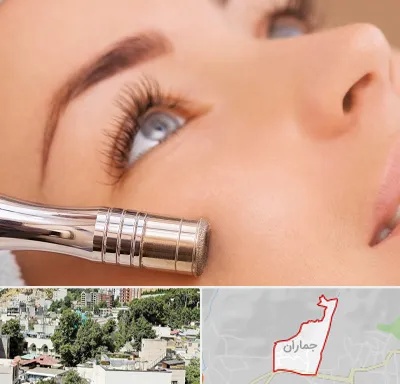 میکرودرم در جماران