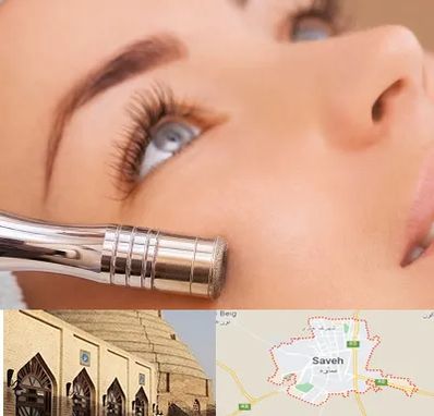 میکرودرم در ساوه