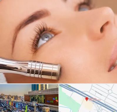 میکرودرم در لاله پارک تبریز