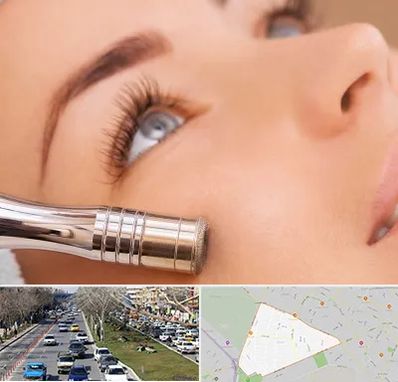 میکرودرم در احمدآباد مشهد