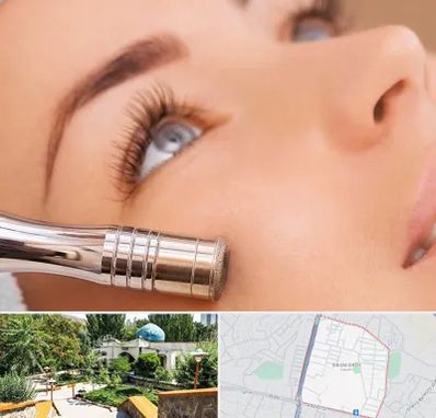 میکرودرم در باغمیشه تبریز