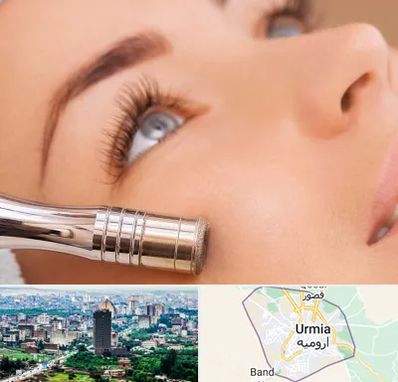 میکرودرم در ارومیه