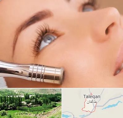میکرودرم در طالقان