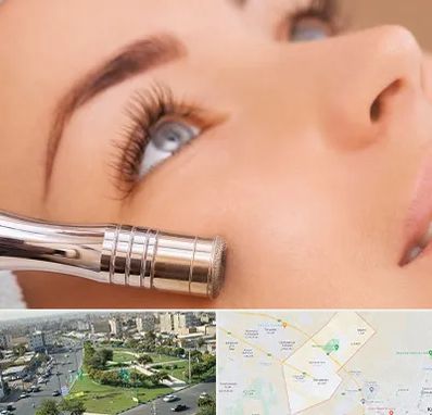 میکرودرم در کمال شهر کرج