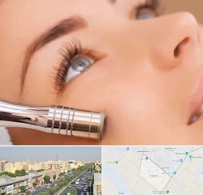 میکرودرم در کیانمهر کرج