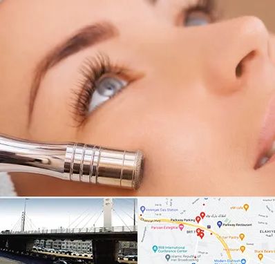 میکرودرم در پارک وی 