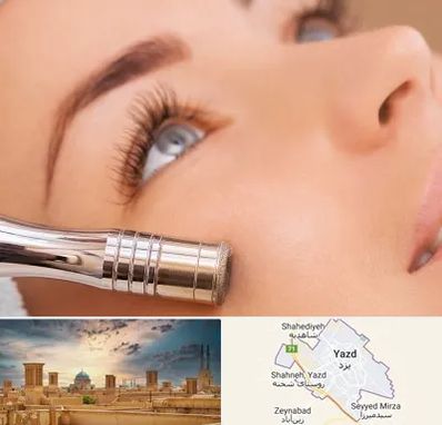 میکرودرم در یزد