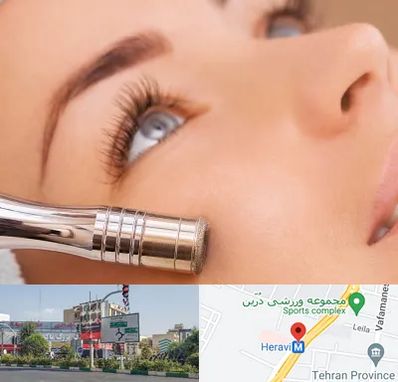 میکرودرم در هروی 