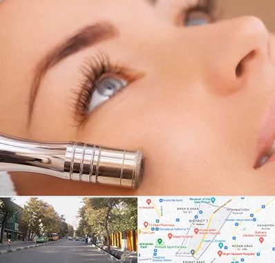 میکرودرم در شریعتی 