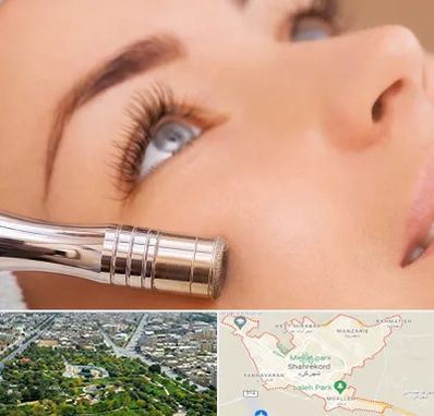 میکرودرم در شهرکرد