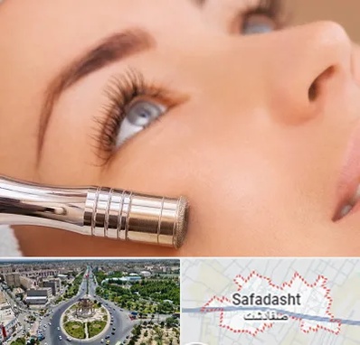 میکرودرم در صفادشت