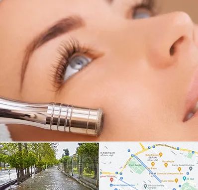 میکرودرم در خیابان ارم شیراز