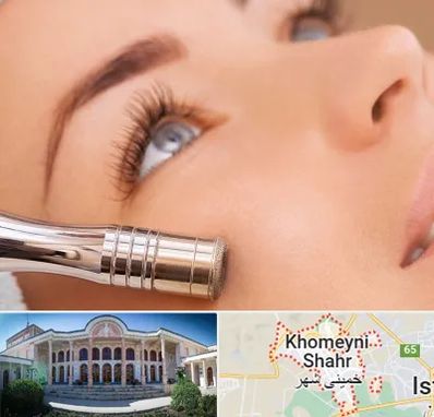 میکرودرم در خمینی شهر