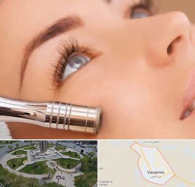 میکرودرم در ورامین